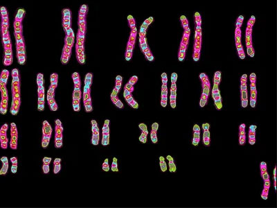 Karyotype